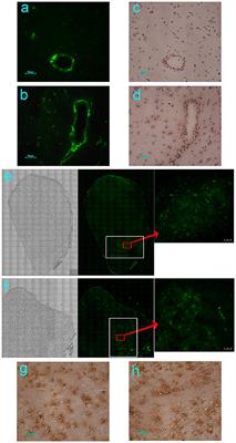 The Preferential Infection of Astrocytes by Enterovirus 71 Plays a Key Role in the Viral Neurogenic Pathogenesis